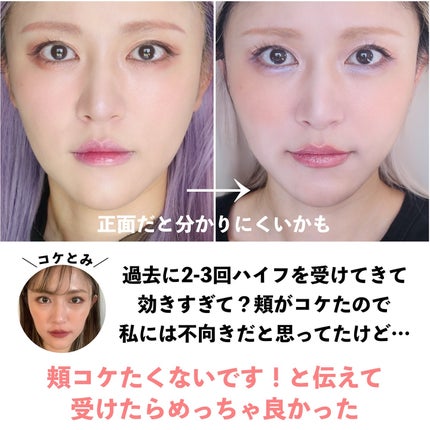 を使ったクチコミ(2枚目)