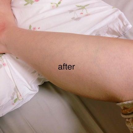 ニードルボディスクラブ/NNE/ボディスクラブを使ったクチコミ(5枚目)