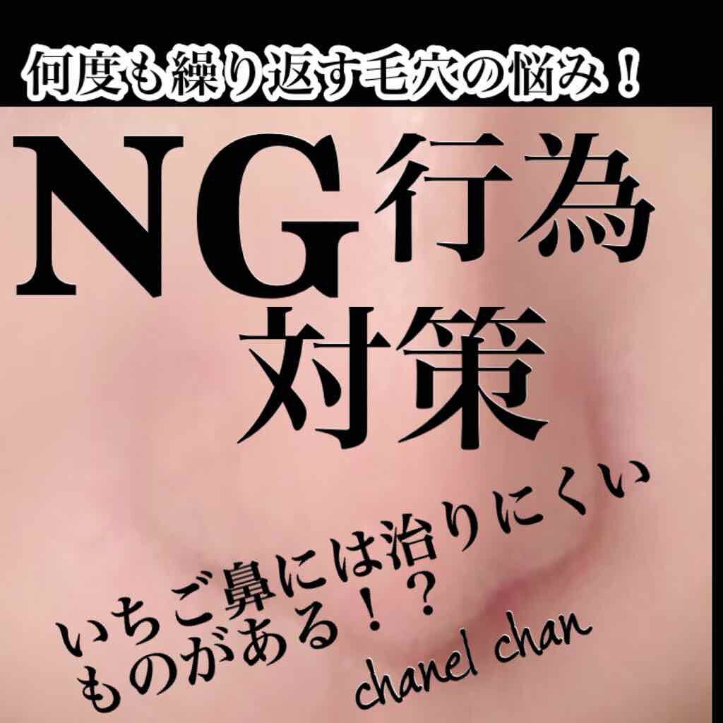 オリジナル ピュアスキンジェリー/ヴァセリン/ボディクリームを使ったクチコミ（1枚目）