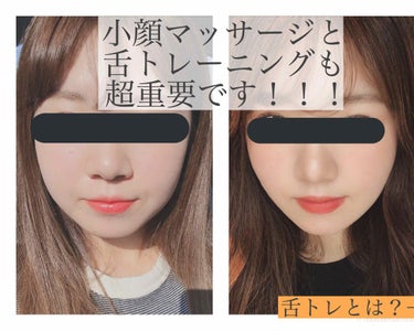 ムンユ on LIPS 「顔面はいくらだって変わる！〜2年弱で20年のコンプレックスを払..」（2枚目）