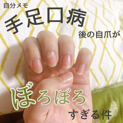 イットネイル パラソル ヌーディメイクネイルカラー/It NAIL/オールインワンネイルを使ったクチコミ(1枚目)