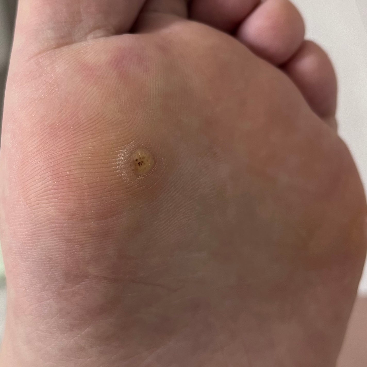 べっぴんはとむぎ/タマチャンショップ/食品を使ったクチコミ(6枚目)