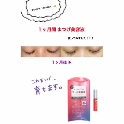スカルプD ボーテ ピュアフリーアイラッシュセラム/アンファー(スカルプD)/まつげ美容液を使ったクチコミ(1枚目)
