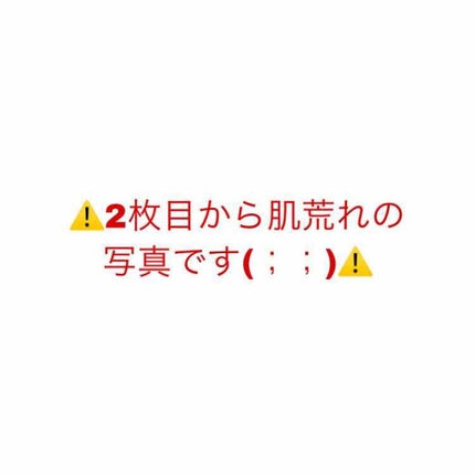 薬用保湿化粧水/オードムーゲ/化粧水を使ったクチコミ(1枚目)