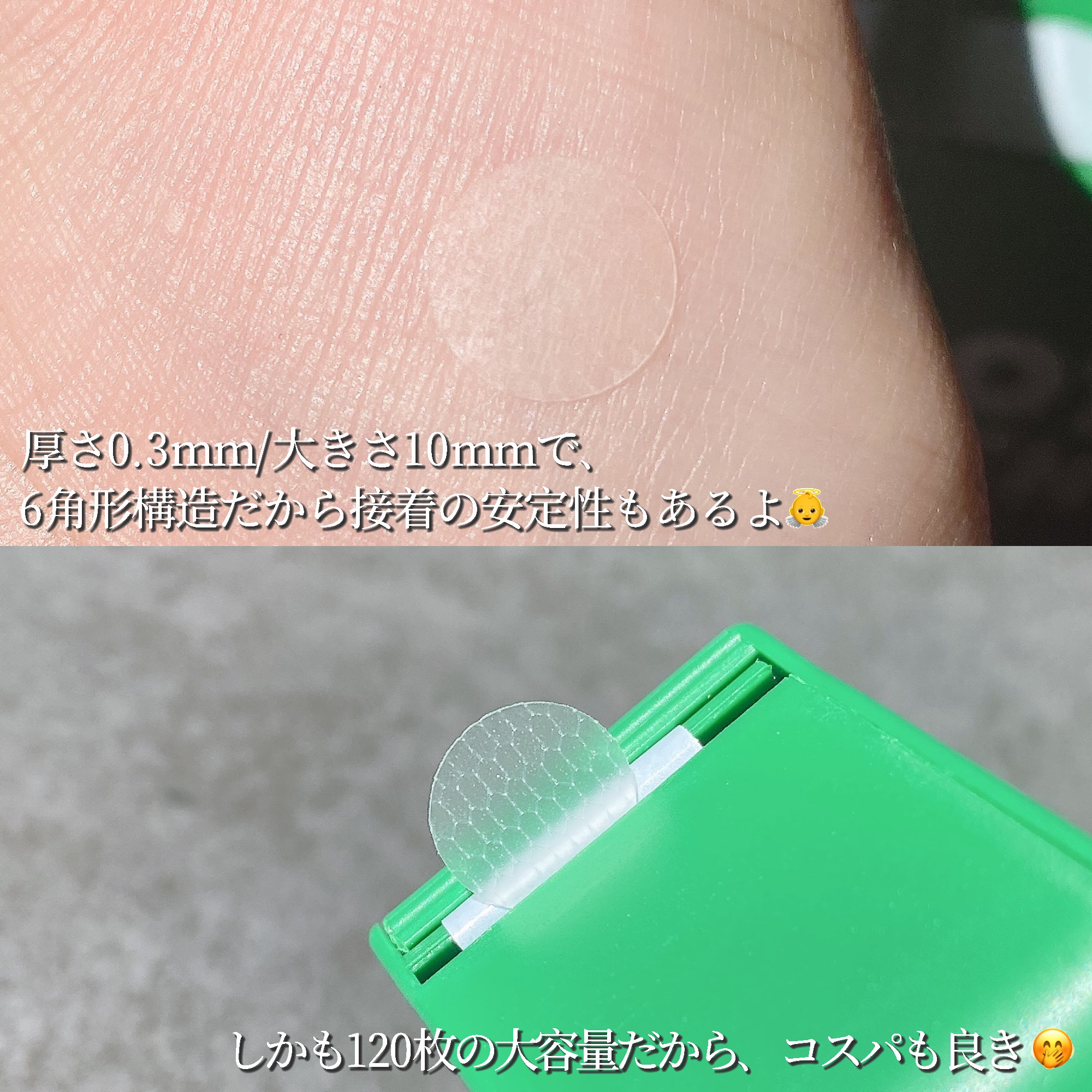 SPOT PATCH ロールタイプ/Shupong/にきびパッチを使ったクチコミ（3枚目）