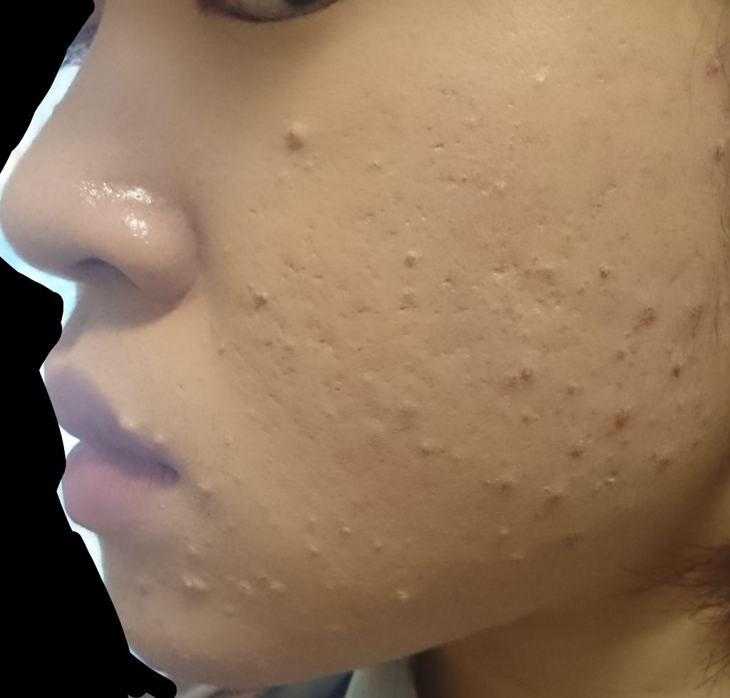 リップザカラー/リップザカラー/口紅を使ったクチコミ（3枚目）