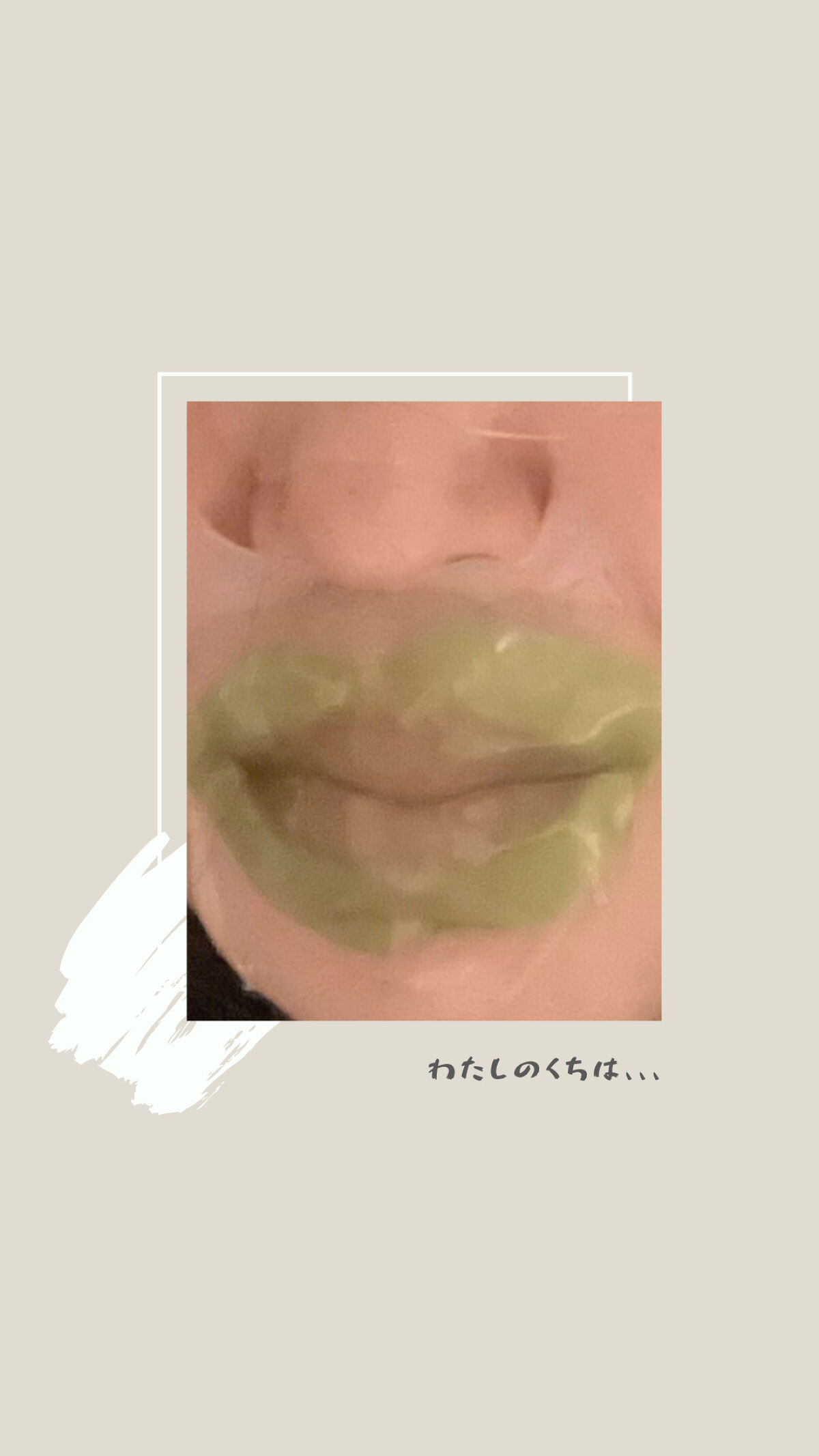 推し活リップパック/CHOOSY/リップマスクを使ったクチコミ（1枚目）