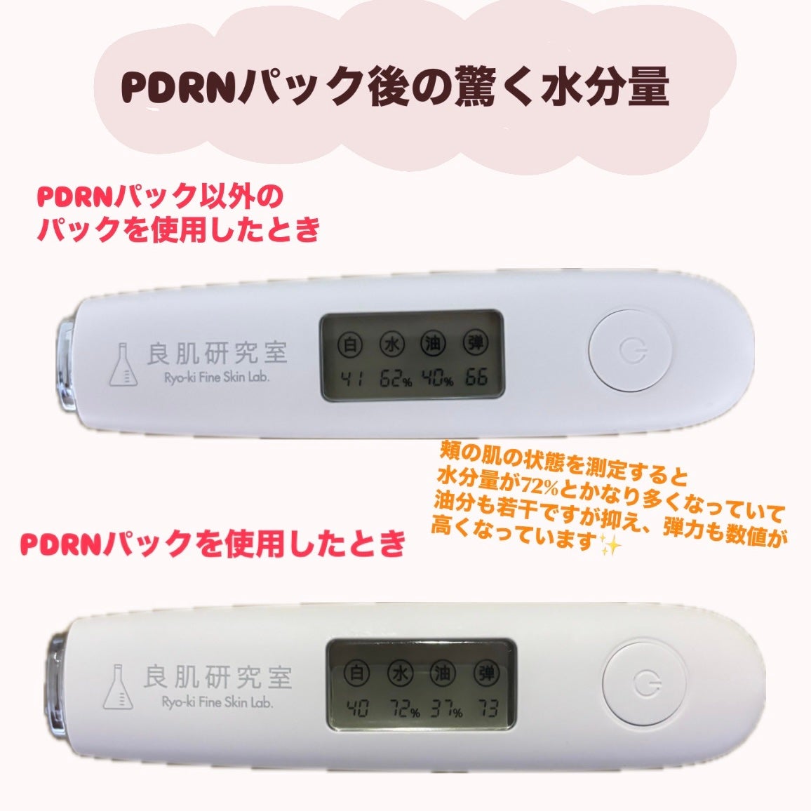 PDRNデイリースペシャルマスク/Milk Touch/シートマスク・パックを使ったクチコミ(4枚目)