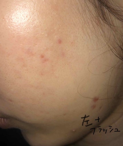 を使ったクチコミ(1枚目)