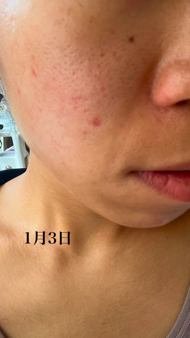 ðªððŽð²ð on LIPS ãæ±èããçŸèèšç»å¹Žæ«åãã1æ3æ¥ãŸã§æŽé¡ãã¹ãã³ã±ã¢ãããŸã..ãïŒ4æç®ïŒ