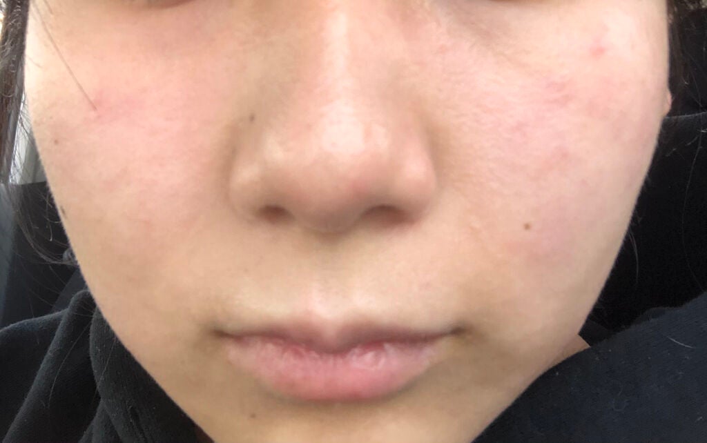 cocco on LIPS 「こんにちは!アドバイス頂きたくて投稿します。私の肌はおそらく、..」(2枚目)