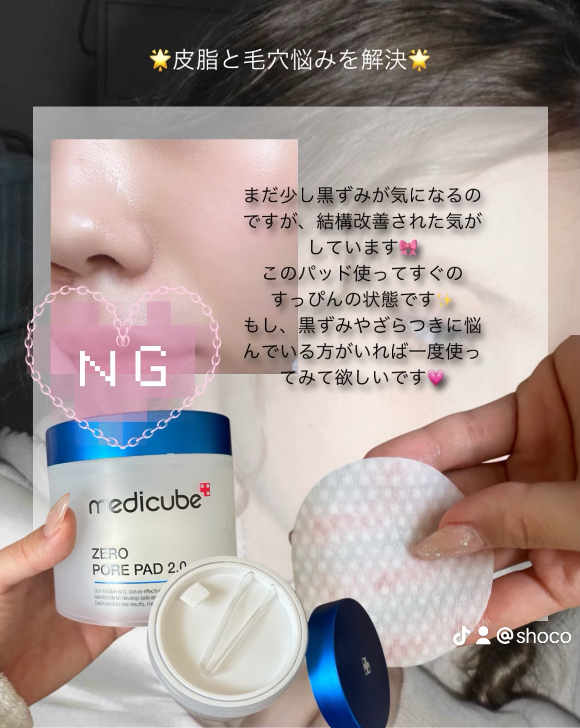 ゼロ毛穴パッド 2.0/MEDICUBE/トナーパッドを使ったクチコミ（3枚目）