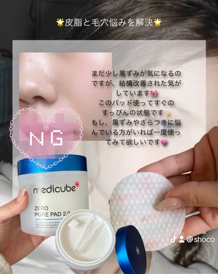 ゼロ毛穴パッド 2.0/MEDICUBE/トナーパッドを使ったクチコミ(3枚目)