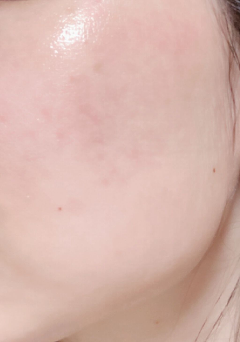 モイストバランス  ローション/ACSEINE/化粧水を使ったクチコミ（1枚目）