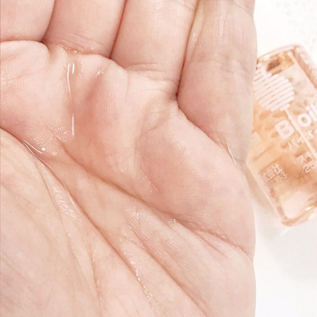 バイオイル/バイオイル/フェイスオイルを使ったクチコミ(3枚目)