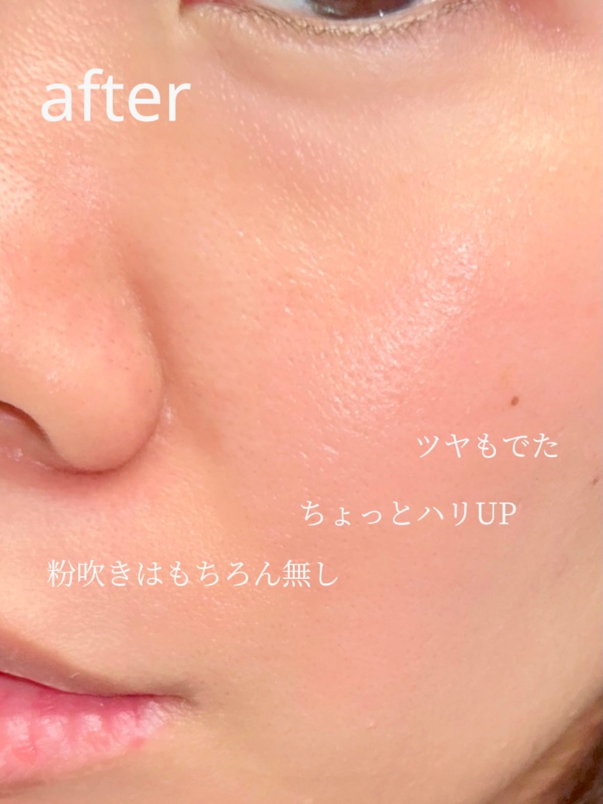 アドバンス ナイト リペア SMR コンプレックス/ESTEE LAUDER/美容液を使ったクチコミ(3枚目)