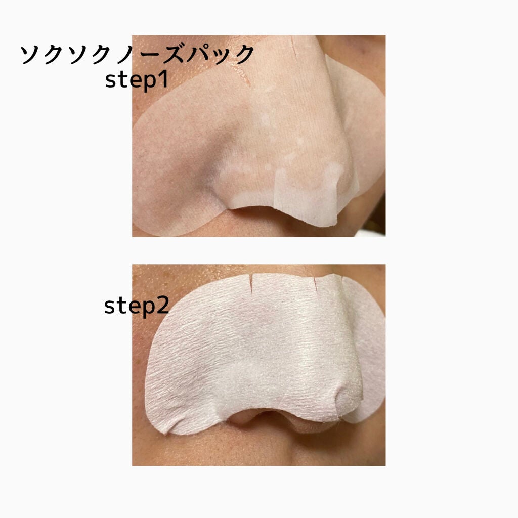 3ステップソクソクノーズパック/MEDIHEAL/シートマスク・パックを使ったクチコミ(4枚目)
