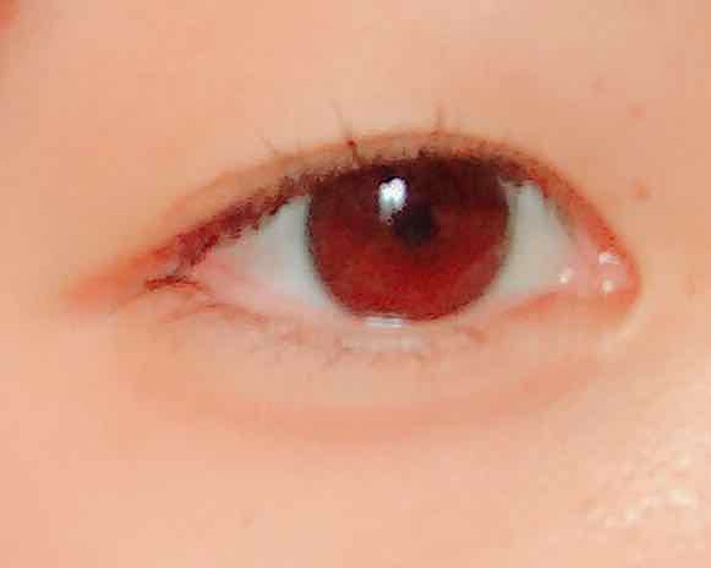 埋没式形成 くっきり二重テープ/DAISO/二重まぶた用アイテムを使ったクチコミ(1枚目)