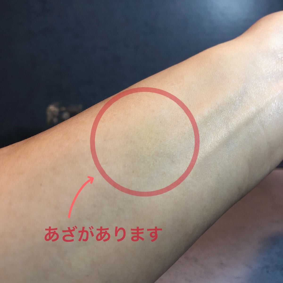 タトゥーウォータープルーフスカーコンシーラー/フォレンコス/リキッドコンシーラーを使ったクチコミ(3枚目)