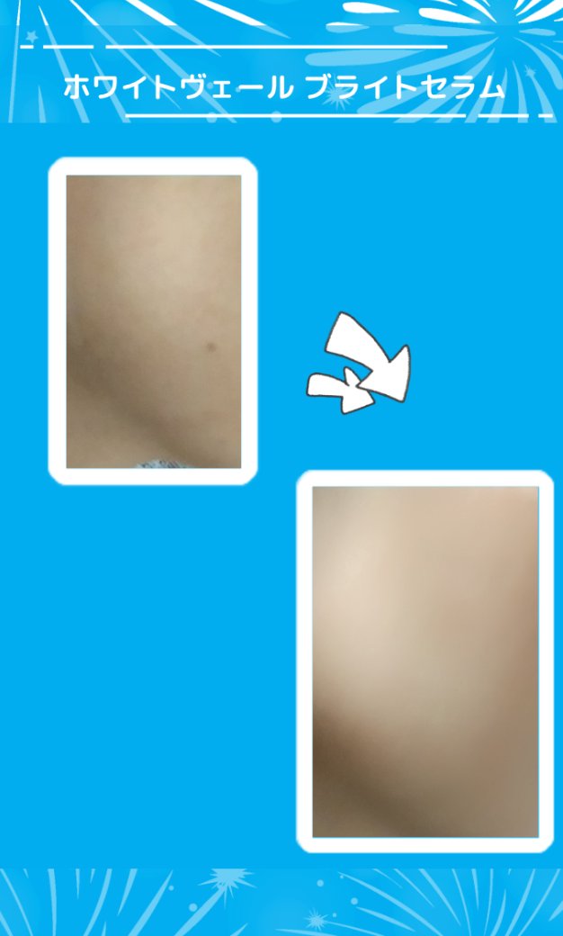 WHITE VEIL ブライトセラムUV/WHITE VEIL/日焼け止めローションを使ったクチコミ（3枚目）