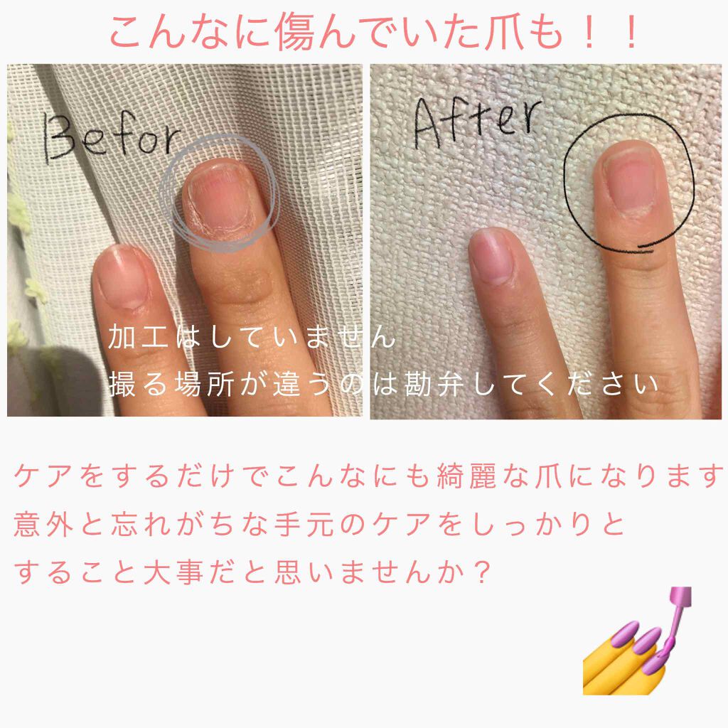 キューティクルスクレイパー スリム/デュカート/ネイル用品を使ったクチコミ(2枚目)