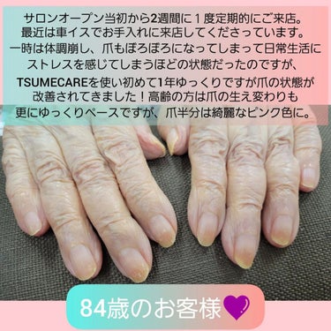 TSUMECARE/NailSalon mayunail/ネイルオイル・トリートメントを使ったクチコミ（2枚目）