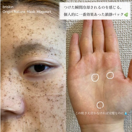 ハイポアレジェニック シカ ジェルクリーム/Dermatory/フェイスクリームを使ったクチコミ(6枚目)