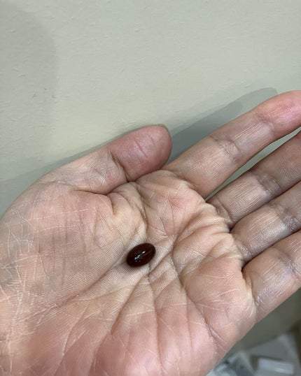 WHITE VEIL Premium/WHITE VEIL/美容サプリメントを使ったクチコミ(3枚目)