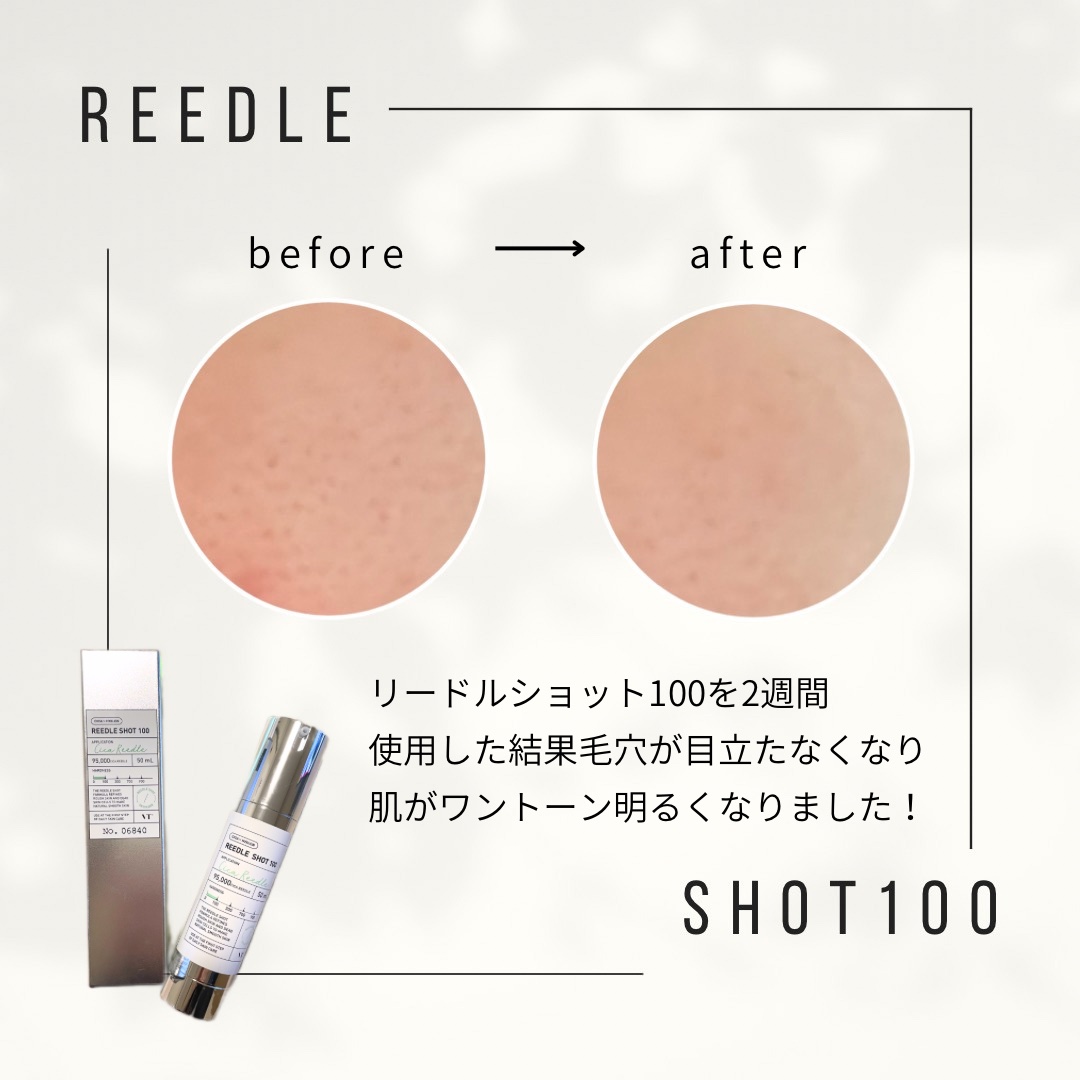 リードルショット100/VT/美容液を使ったクチコミ（2枚目）