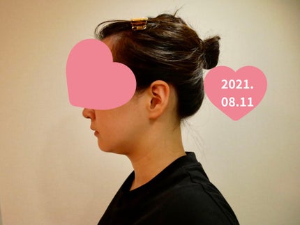 現実頭皮/ラッシュ/頭皮トリートメントを使ったクチコミ(4枚目)