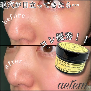 ♡aetem(エテム)♡
　ブラックレモンウォッシュオフパック
　【参考価格 ¥1,890】MADE IN KOREA


🌼使用感🌼
　レモンの様なすっきりとした柑橘系の香り🍋
　伸ばしやすく柔らかい