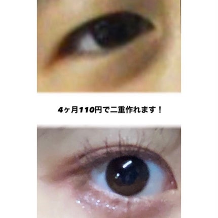 のびーるアイテープ(絆創膏タイプ、レギュラー)/DAISO/二重まぶた用アイテムを使ったクチコミ(1枚目)