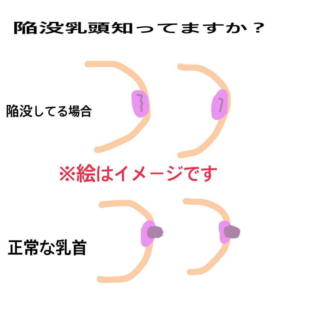 ジョンソン ベビーオイル 無香料/ジョンソンベビー/ボディオイルを使ったクチコミ（2枚目）