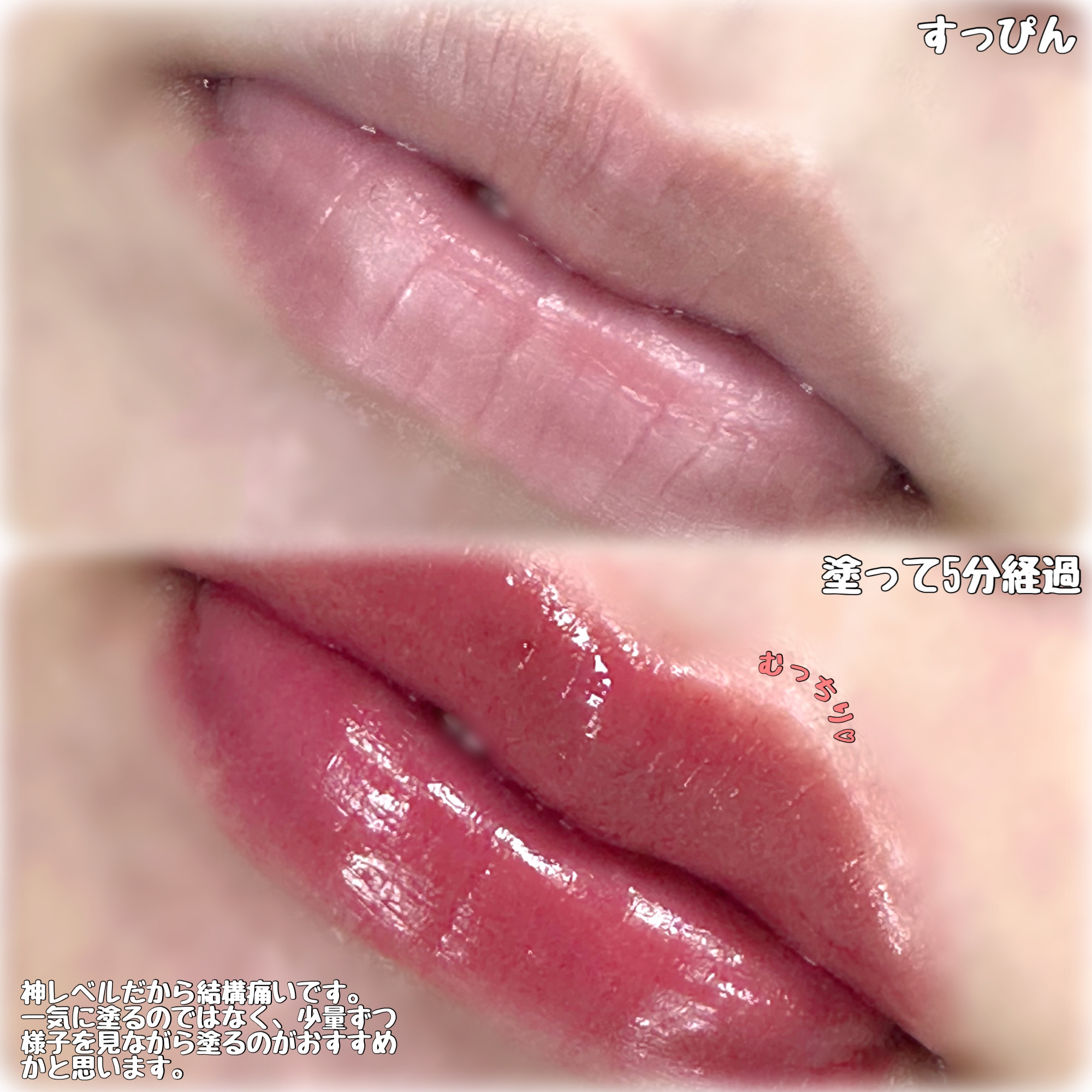 ドトムリッププラスプランパー/keybo/リッププランパーを使ったクチコミ（3枚目）