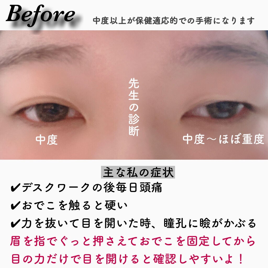 Fabulous(ファビュラス)1month/FABUROUS/カラーコンタクトレンズを使ったクチコミ(3枚目)