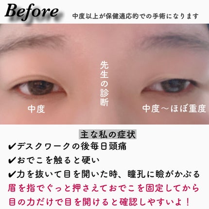 Fabulous(ãã¡ãã¥ã©ã¹ïŒ1month/FABUROUS/ã«ã©ãŒã³ã³ã¿ã¯ãã¬ã³ãºã䜿ã£ãã¯ãã³ãïŒ3æç®ïŒ