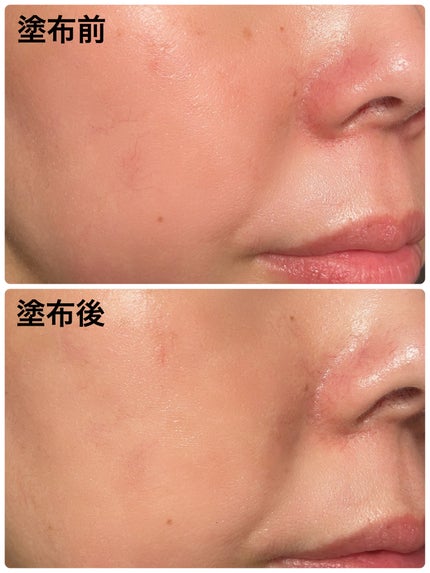 トリートメント デイ クリーム/COVERMARK/日焼け止めクリームを使ったクチコミ(5枚目)