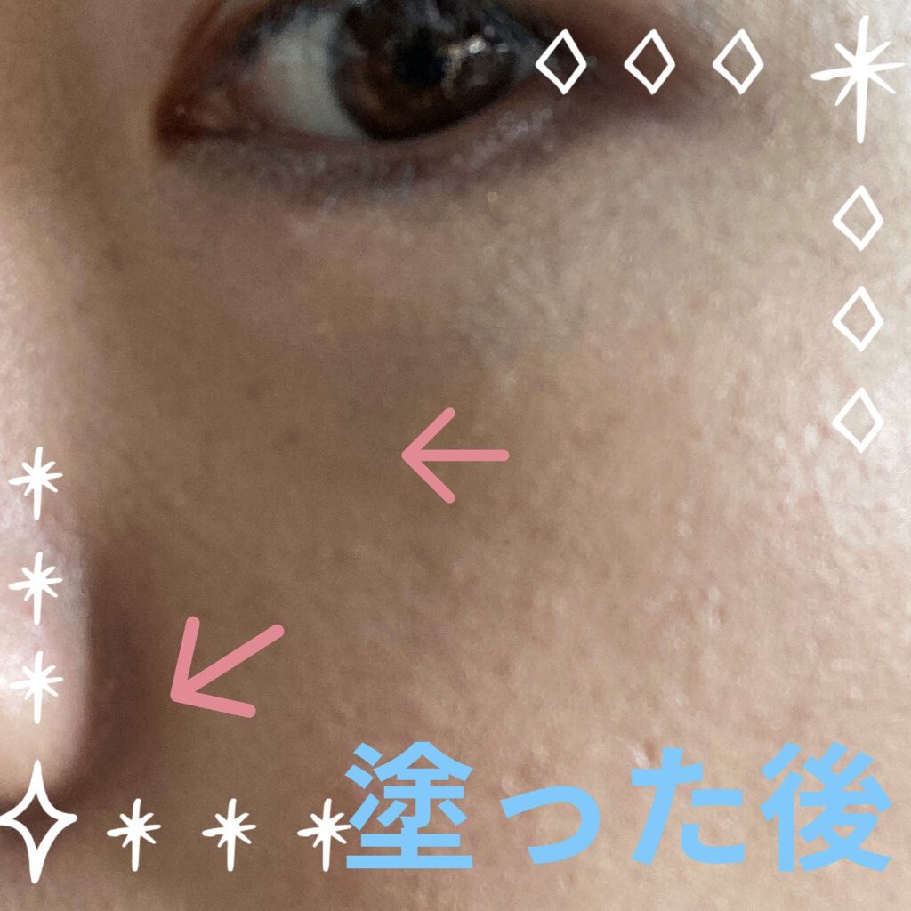 ドクタージャルト シカペア リカバー (第2世代）/Dr.Jart＋/フェイスクリームを使ったクチコミ（3枚目）