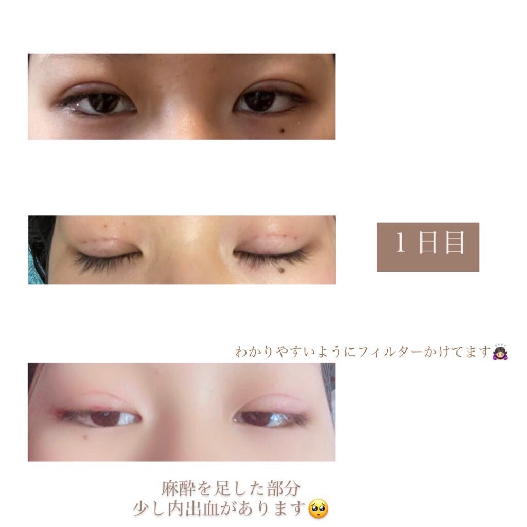 ððððð on LIPS ãðããã«ã¡ã¯åããŸããŠððððã§ãð€2021幎1æ16æ¥ã«å没..ãïŒ3æç®ïŒ