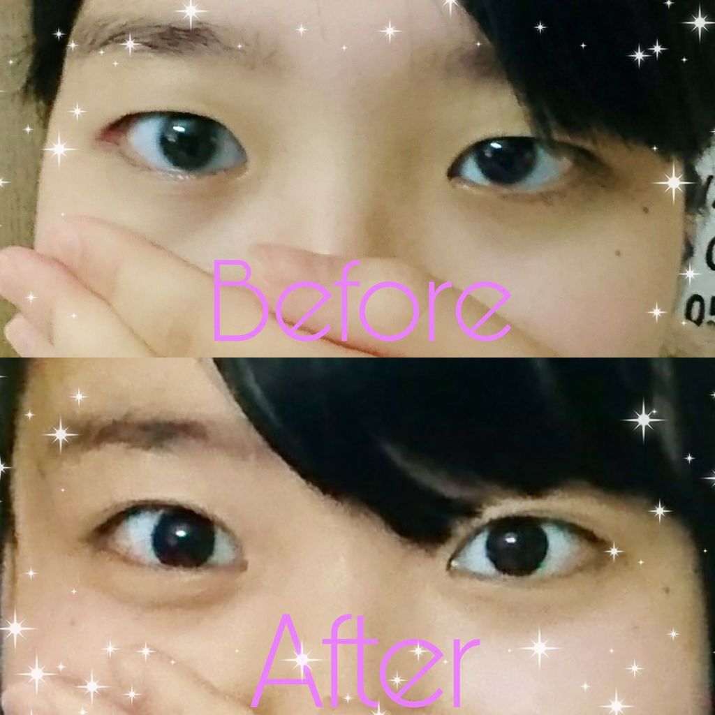 アイビューティー フィクサー WP/アストレア ヴィルゴ/二重まぶた用アイテムを使ったクチコミ（1枚目）