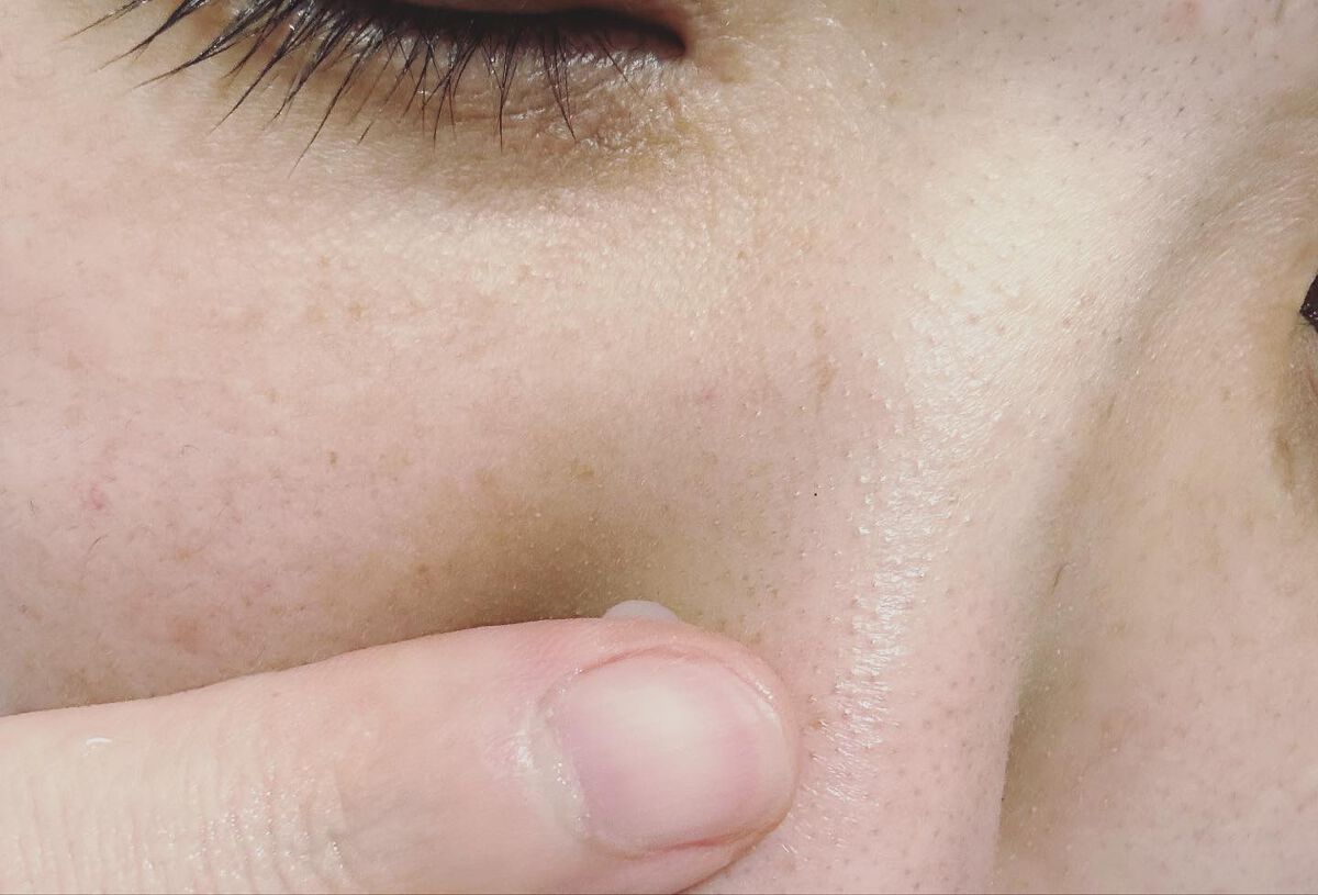 チョコブラ スペシャル毛穴ケアセット/Chocobra/スキンケアキットを使ったクチコミ(7枚目)