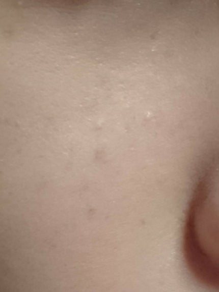 フィットミー コンシーラー/MAYBELLINE NEW YORK/リキッドコンシーラーを使ったクチコミ(3枚目)