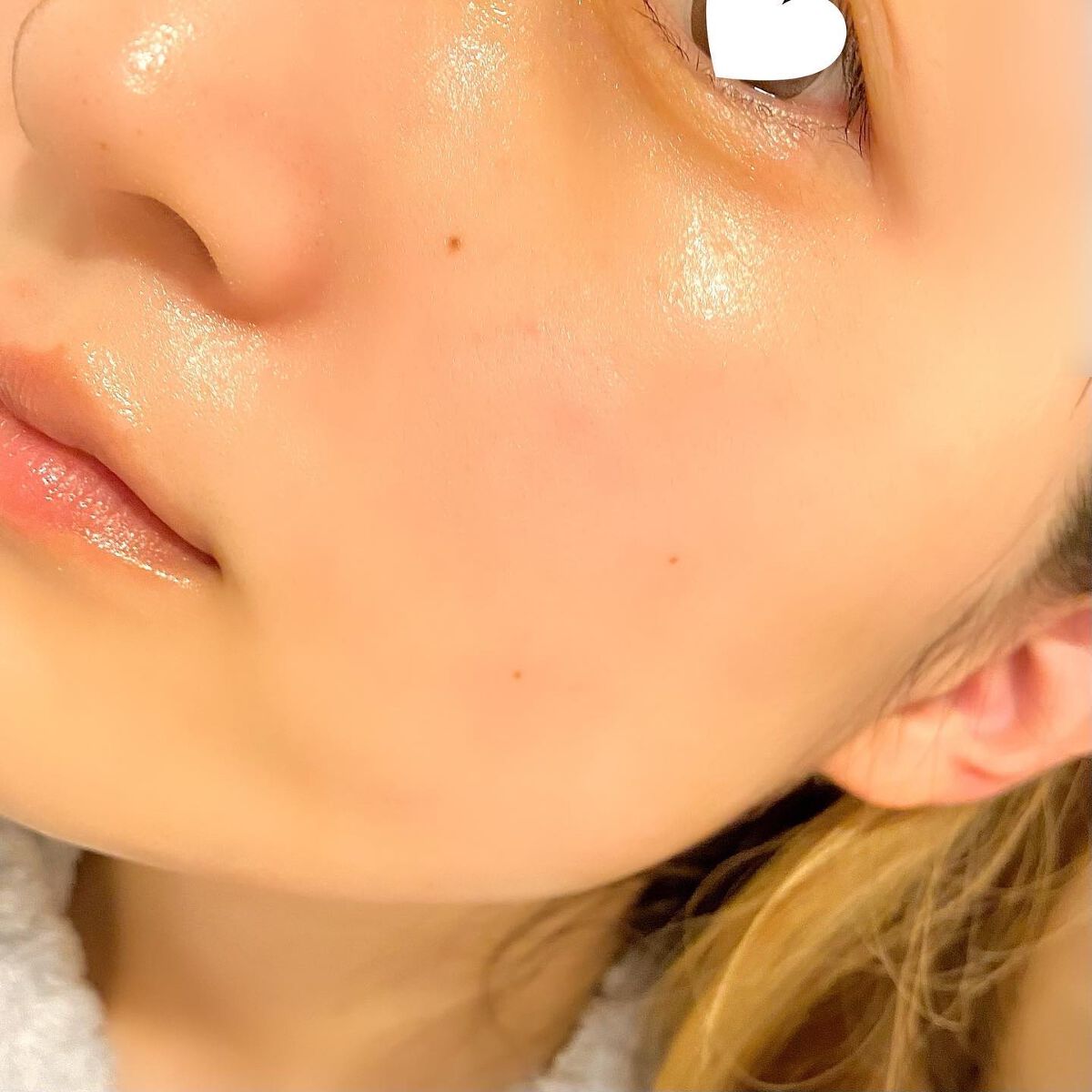 ダーマレーザースーパーVC100マスク/クオリティファースト/シートマスク・パックを使ったクチコミ(6枚目)