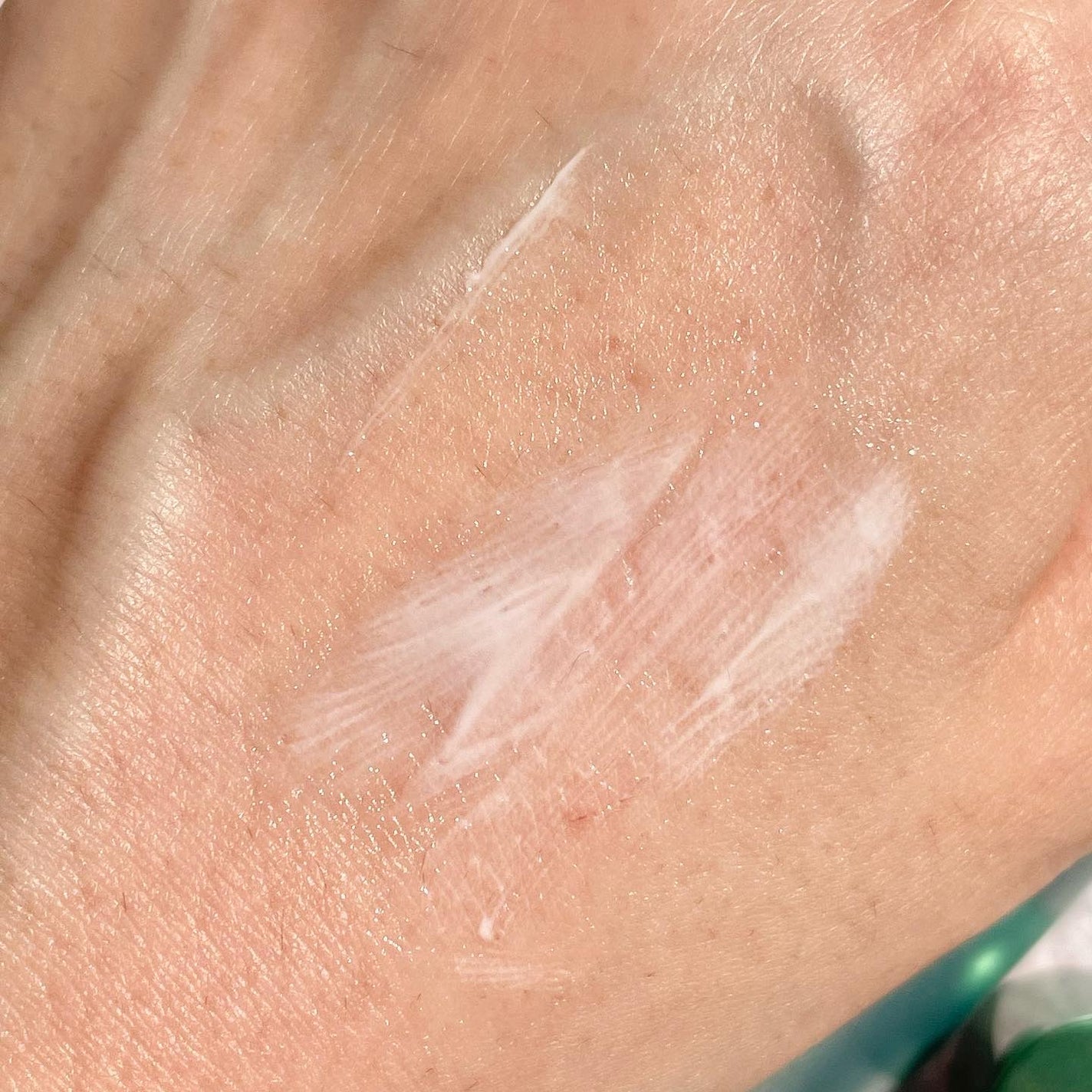 ダーマセプトRX AZAセラム/ダーマセプトRX/美容液を使ったクチコミ(3枚目)