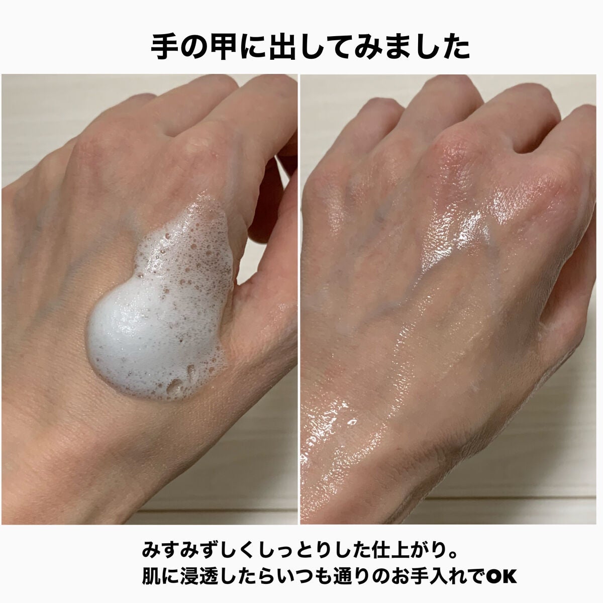 フェルゼアプレミアム 薬用泡の化粧水/フェルゼア/化粧水を使ったクチコミ(5枚目)