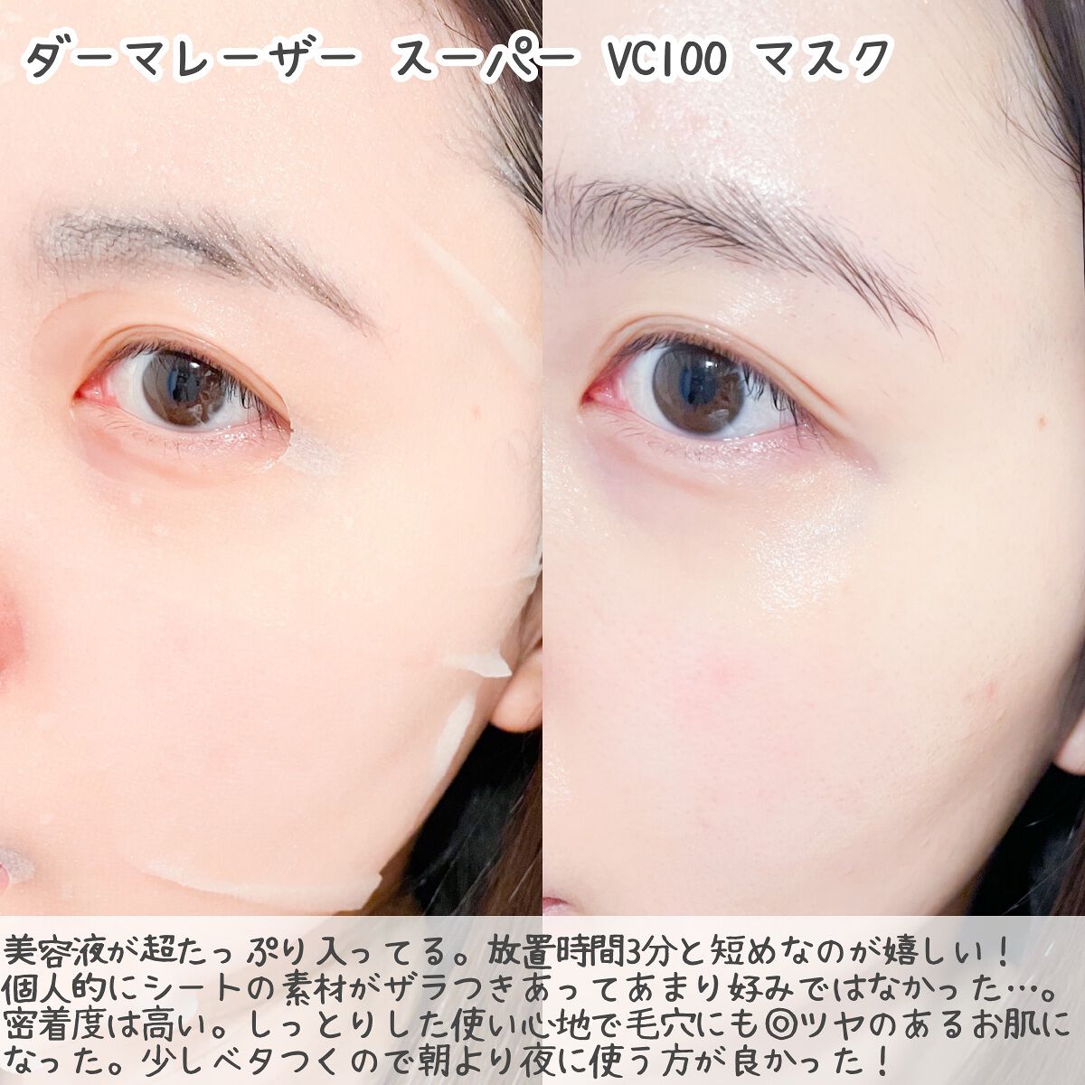 お米のマスク/毛穴撫子/シートマスク・パックを使ったクチコミ(5枚目)