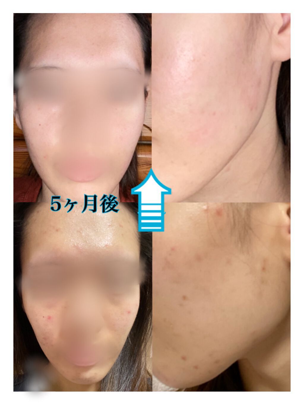 青箱 (さっぱり)/カウブランド/ボディ石鹸を使ったクチコミ（2枚目）