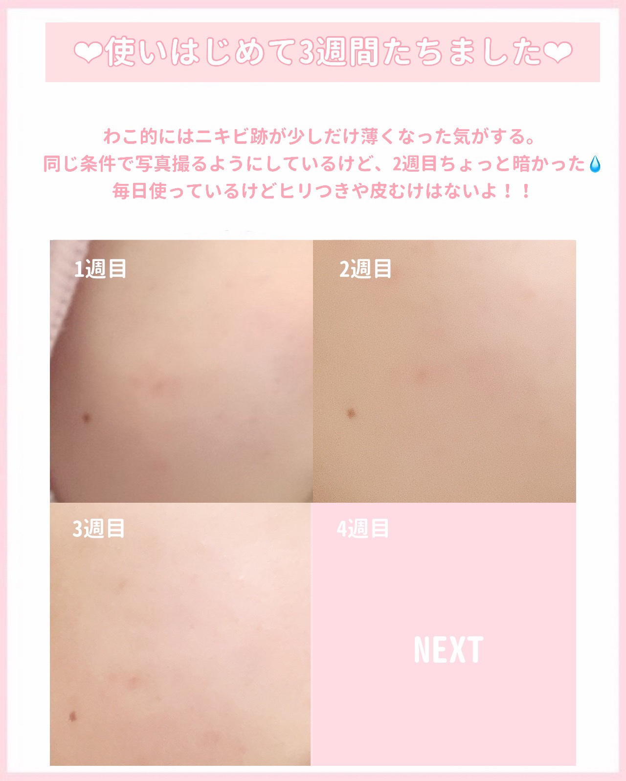 ビタペアC ビタレチ美容液/ネイチャーリパブリック/美容液を使ったクチコミ（3枚目）