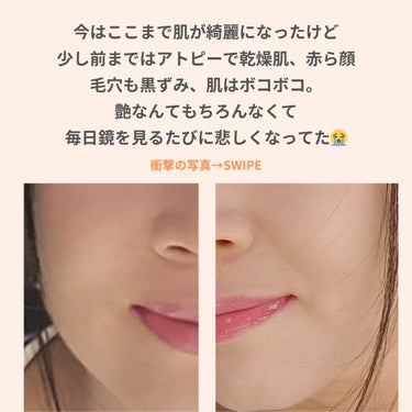 美肌カウンセラー💆綺麗のお助け相談所 on LIPS 「あなたはもっと綺麗になれる✨変わらない肌はなく、変われない肌は..」（2枚目）