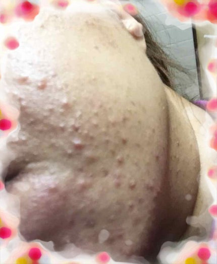 明色美顔水 薬用化粧水/美顔/化粧水を使ったクチコミ(2枚目)